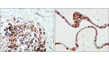 Collagen IV /COL4A1 Antibody