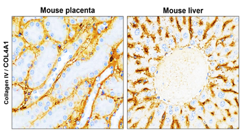 Collagen IV /COL4A1 Antibody