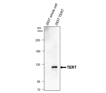 TERT (N-terminal doamain) Rabbit Polyclonal Antibody