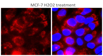 TERT (N-terminal doamain) Rabbit Polyclonal Antibody