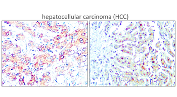 TERT (N-terminal doamain) Rabbit Polyclonal Antibody