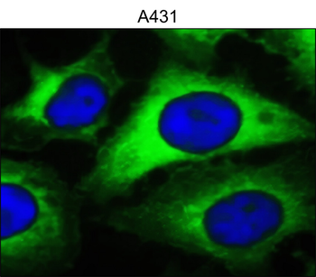 NF-κB p65 Mouse Monoclonal Antibody