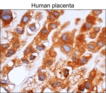 NF-κB p65 Mouse Monoclonal Antibody