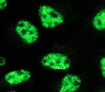STAT6 Mouse Monoclonal Antibody