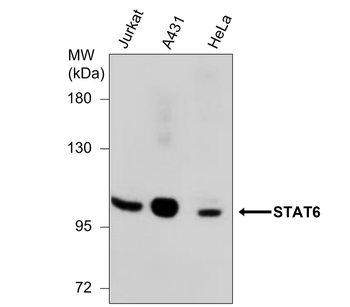 STAT6 Mouse Monoclonal Antibody