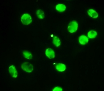 STAT1, monoclonal antibody