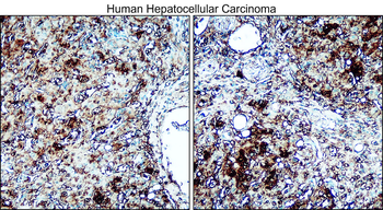 Osteopontin Mouse Monoclonal Antibody