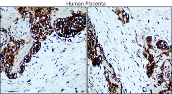Osteopontin Mouse Monoclonal Antibody