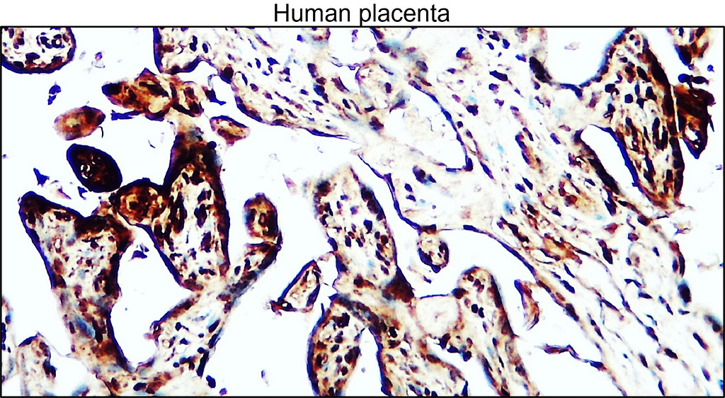 MCP-1 / MCAF antibody [PD-5]