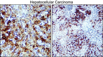 Factor IX / F9 antibody [PB-3]