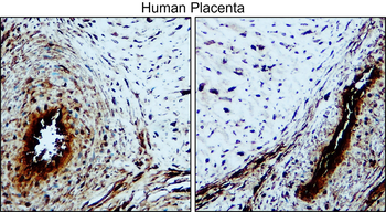 Factor IX / F9 antibody [PB-3]