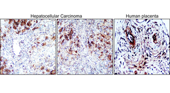 Factor IX / F9 antibody [PB-3]