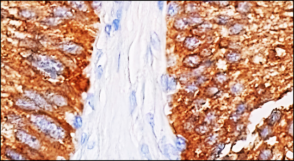 Hexokinase II / HK2, monoclonal antibody