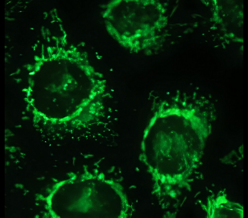 Hexokinase II / HK2, monoclonal antibody