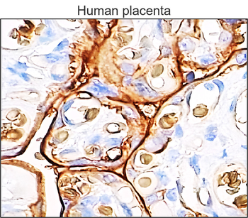 GLUT1 Glucose Transporter Mouse Monoclonal Antibody