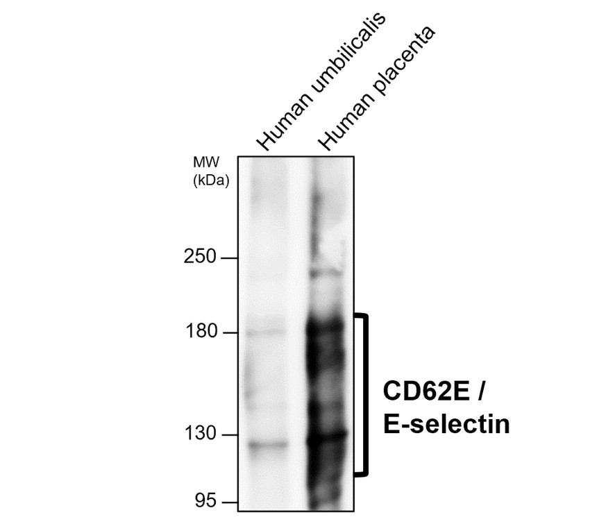 CD62E / E-selectin antibody [PH-7]