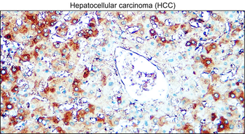 AIF Mouse Monoclonal Antibody