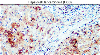 AIF Mouse Monoclonal Antibody