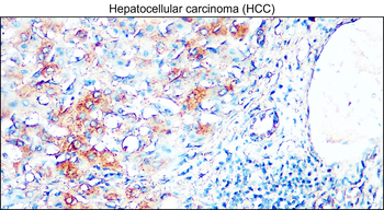AIF Mouse Monoclonal Antibody