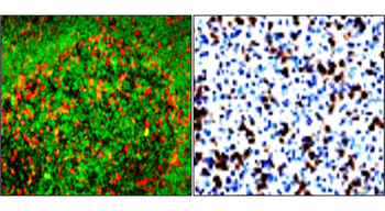 PD1 Mouse Monoclonal Antibody