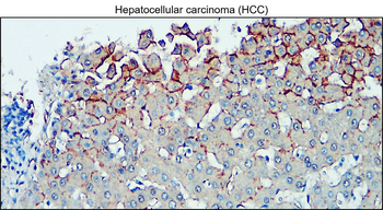 VE-cadherin/CDH5/CD144 Antibody