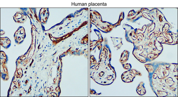 VE-cadherin/CDH5/CD144 Antibody