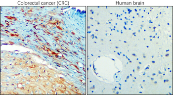 Carbonic Anhydrase IX Rabbit Polyclonal Antibody