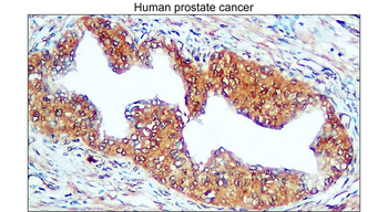 Carbonic Anhydrase IX Rabbit Polyclonal Antibody