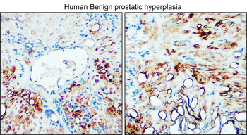 TGF beta 1 Rabbit Polyclonal Antibody