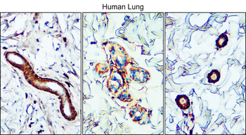 TGF beta 1 Rabbit Polyclonal Antibody