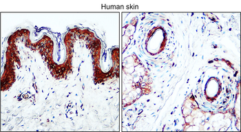 TGF beta 1 Rabbit Polyclonal Antibody