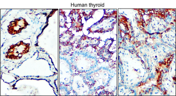 TGF beta 1 Rabbit Polyclonal Antibody