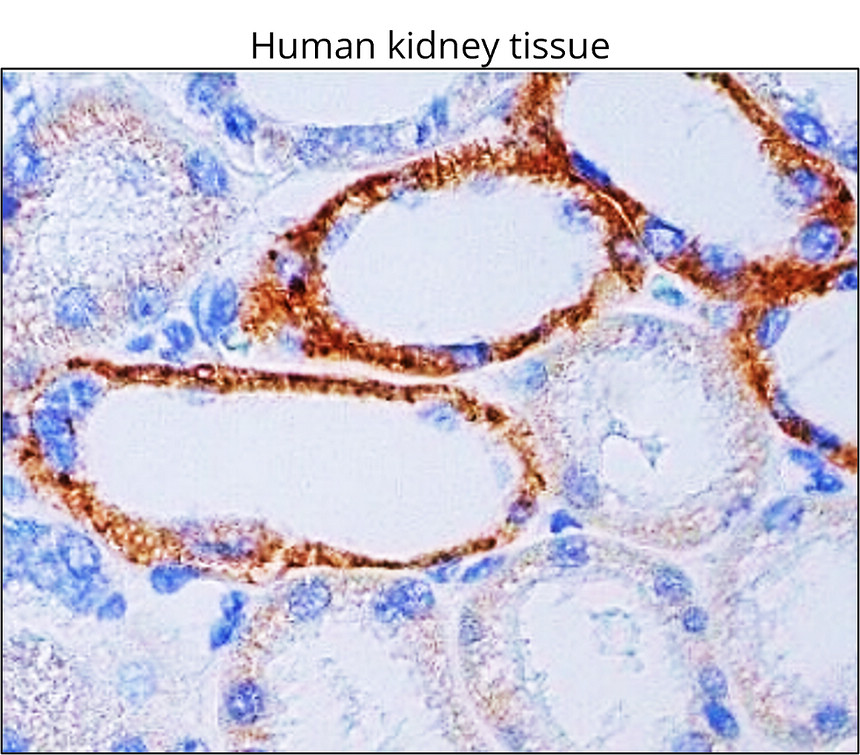TSG101, monoclonal antibody