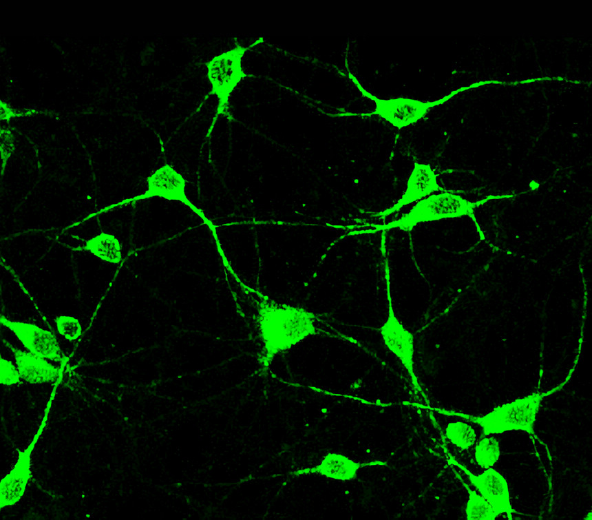 GFP , monoclonal antibody