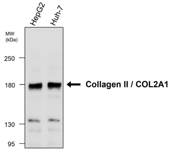 Collagen II /COL2A1 Antibody