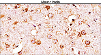 PTEN Mouse Monoclonal Antibody