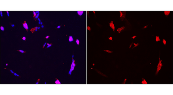 Zebrafish Toll-like Receptor 18 Rabbit Polyclonal Antibody