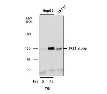 Endoplasmic Reticulum / ER Stress Antibody Panel