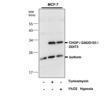 Endoplasmic Reticulum / ER Stress Antibody Panel