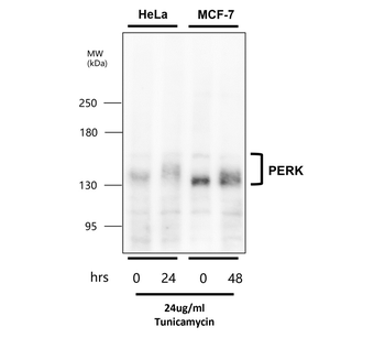 Endoplasmic Reticulum / ER  Stress Antibody Panel