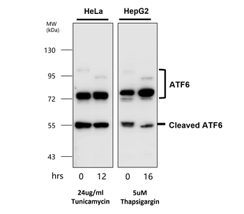 Endoplasmic Reticulum / ER  Stress Antibody Panel