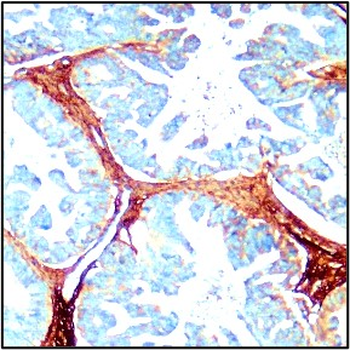 Extracellular Matrix / ECM Profiling Antibody Panel