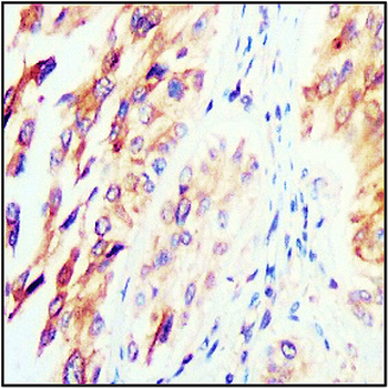 Extracellular Matrix / ECM Profiling Antibody Panel
