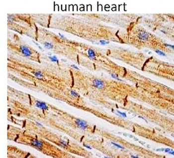 Cardiovascular Antibody Panel