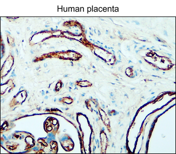 Microvascular Density Antibody Panel