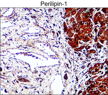Adipogenesis Marker Antibody Panel