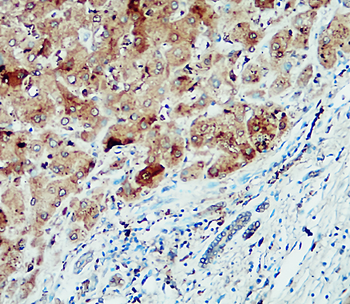 Inflammasome Antibody Panel