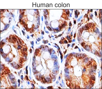 Inflammasome Antibody Panel