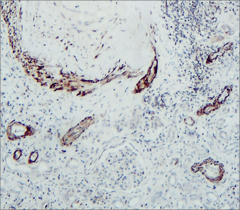 Matrix Remodeling Antibody Panel