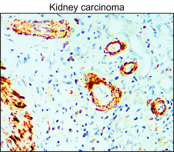 Matrix Remodeling Antibody Panel